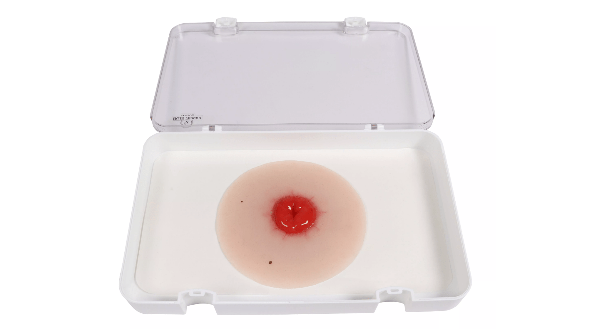 Wundmoulage Kolostoma, selbsthaftend - Erler - Zimmer